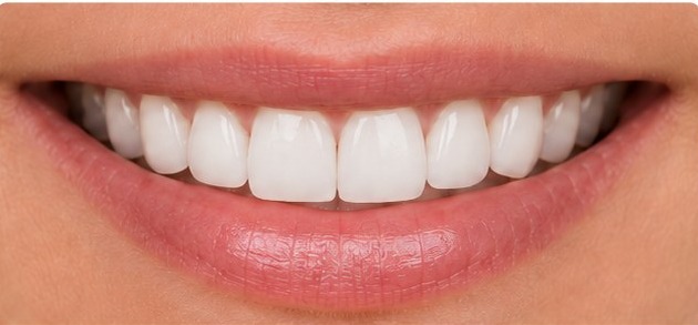 Il sorriso dopo: l'anteprima ottenuta con il mockup emozionale