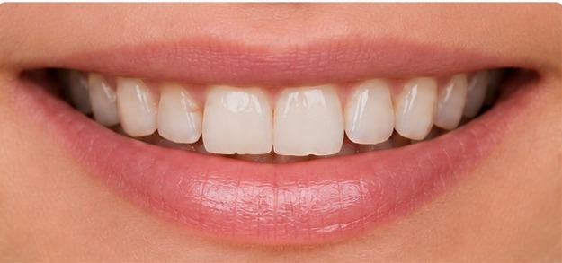 Il sorriso prima: la situazione di partenza da valutare